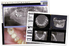 歯科用CT